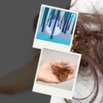 Environmental Factors