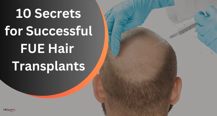 10 Secrets for Successful FUE Hair Transplants