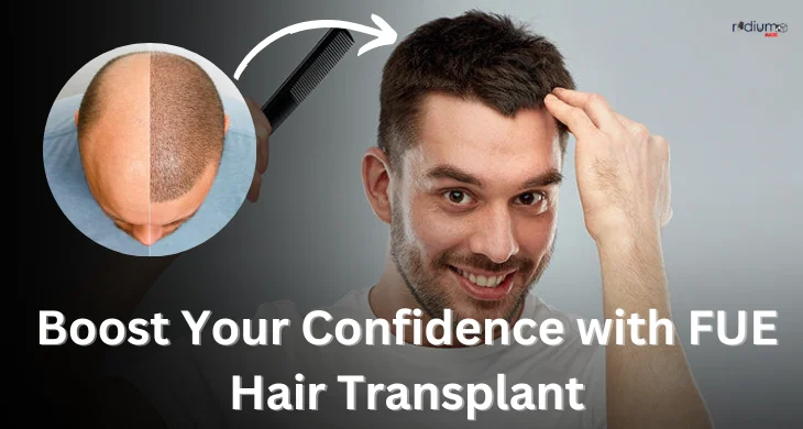 boost your confidence with FUE hair transplant
