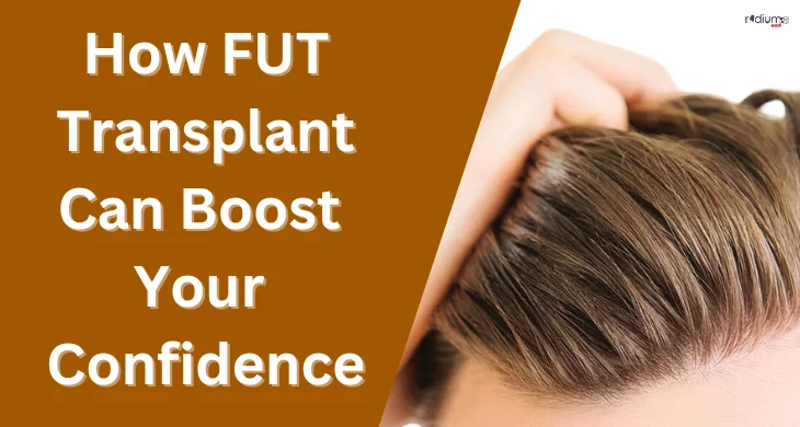how fut transplant can boost your confidence