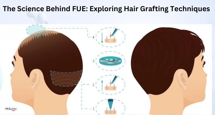 the science behind fue exploring hair grafting techniques