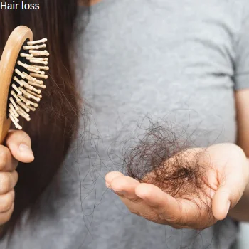 hair loss
